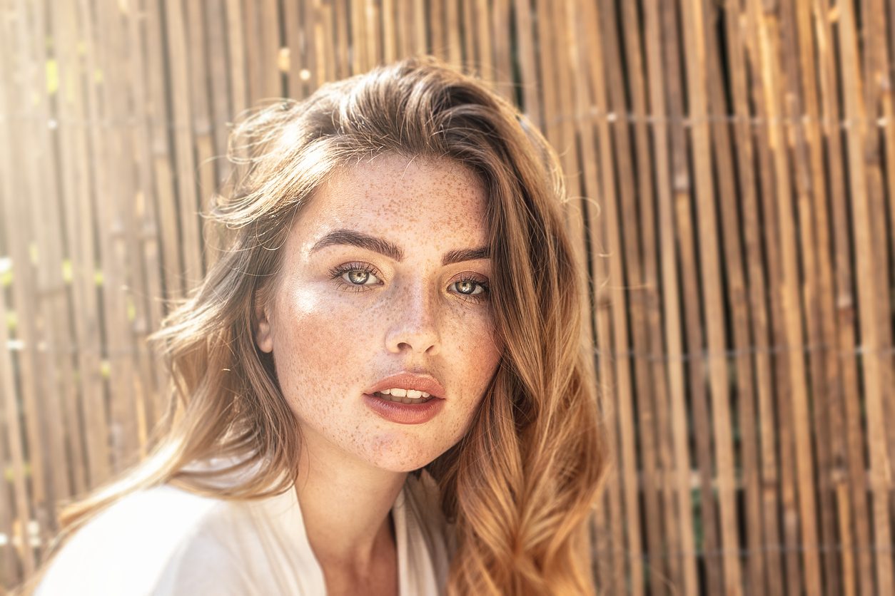 iStock/ اختلالات في الجسم تحولت إلى علامات للجمال