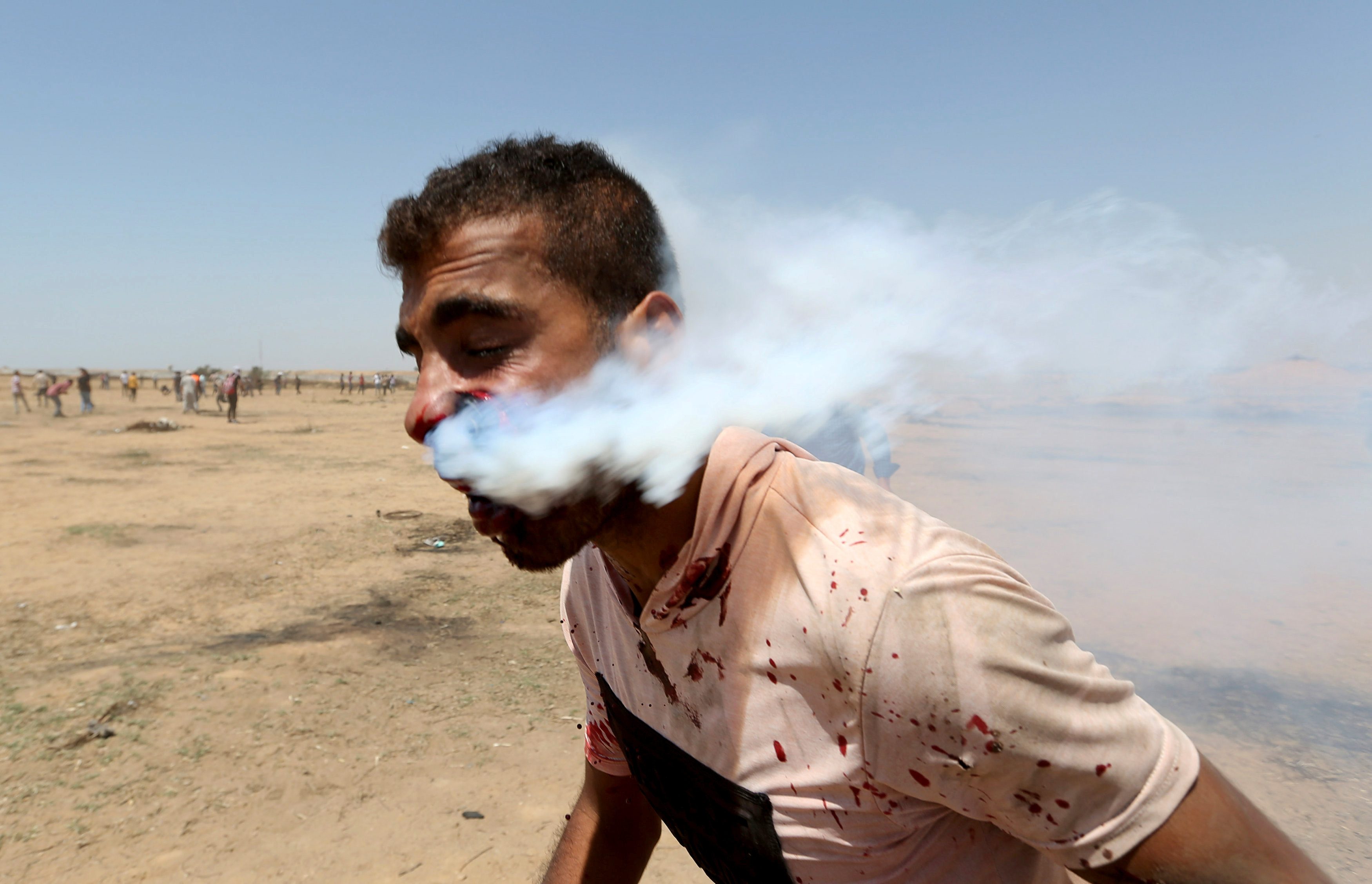 قنبلة غاز استقرت بوجهه، وخرج الدخان من أنفه وفمه وأذنيه.. هذه حكاية “أبو سبلة” الفلسطيني الذي صدمت صورته العالم