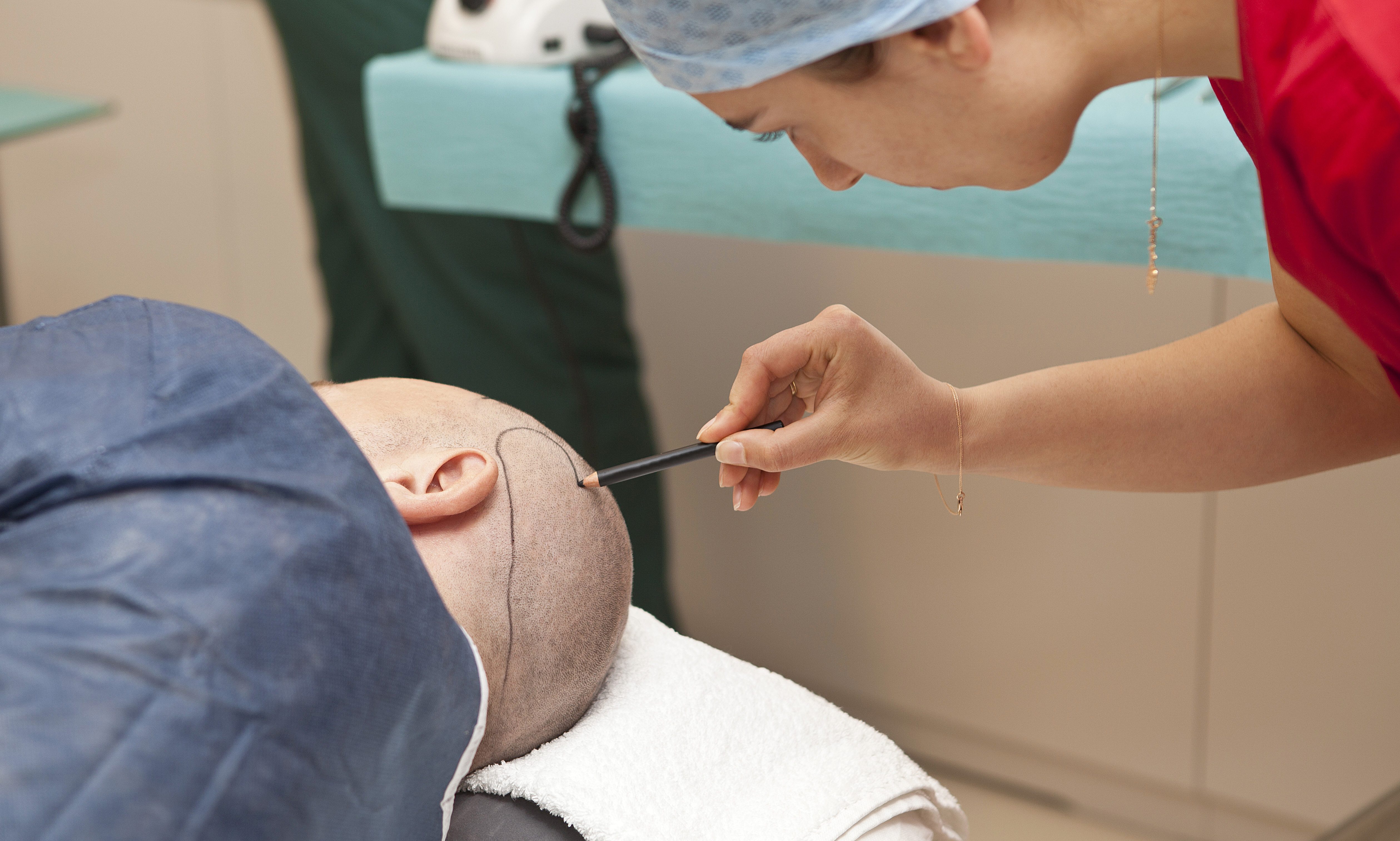 السياحة العلاجية ، زراعة الشعر