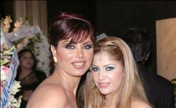 نورمان أسعد بعد عمليات التجميل