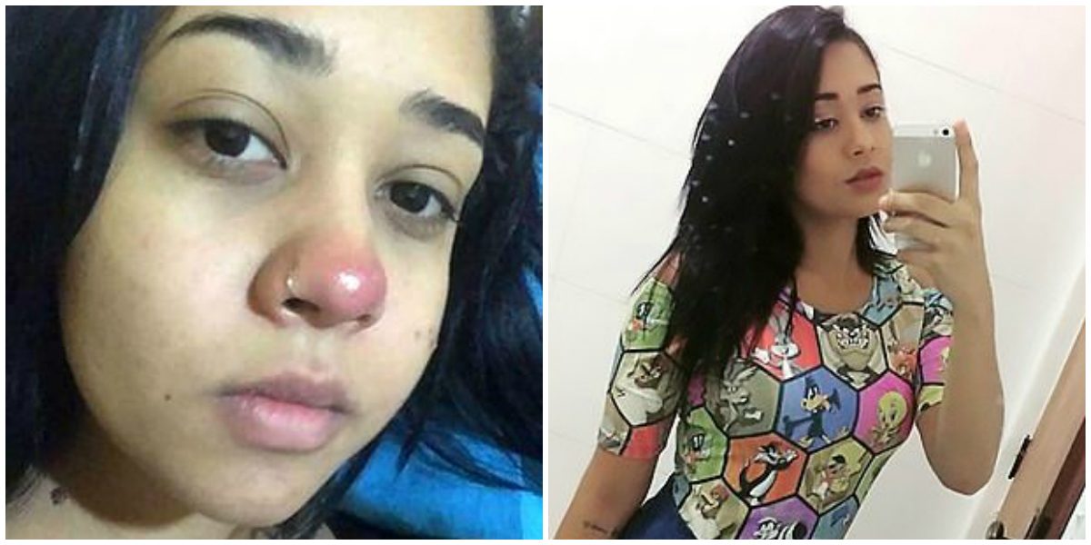 شابة صغيرة تصاب بالشلل التام بسبب ثقب في الأنف!