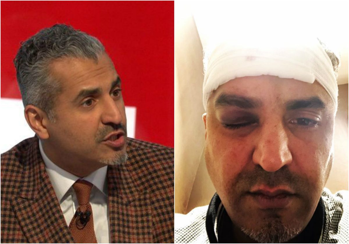 المذيع ماجد نواز قبل وبعد تعرضه للاعتداء
