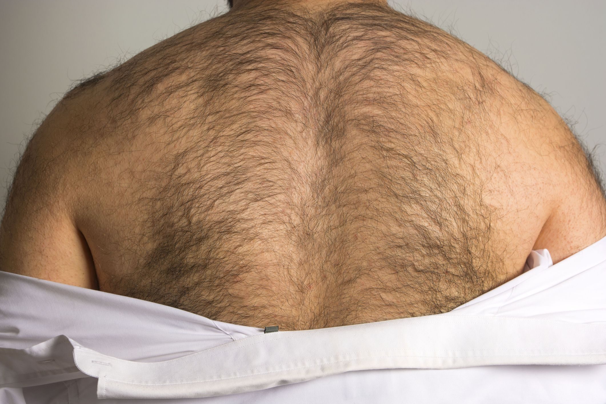 الليزر باهظ الثمن والأمواس تسبب التهابات.. كيف تتخلص من شعر الظهر بشكل فعال؟