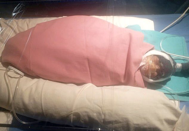 مُسنة هندية تلد طفلة وزنها 600 غرام فقط لتصبح أكبر أم تُنجب مولوداً في العالم