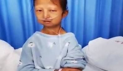 لم تعد تأكل ووزنها أصبح 21 كيلوغراماً، وعملت في وظيفتين!.. غضب في الصين لأجل شابة تدعم أخاها المريض