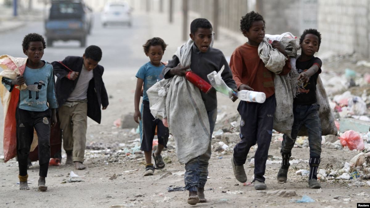 أطفال اليمن الحرب في اليمن
