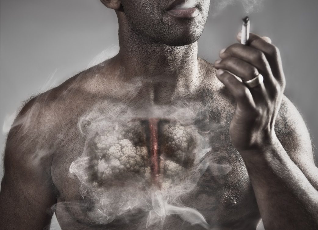 ليس له أعراض قبل انتشاره.. أعراض سرطان الرئة وتجنب وصوله لمراحل متدهورة