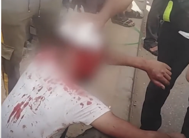 “ضربه وتركه غارقاً في دمه وهرب”.. غضب في مصر بسبب اعتداء شرطي على سائق أجرة (فيديو)