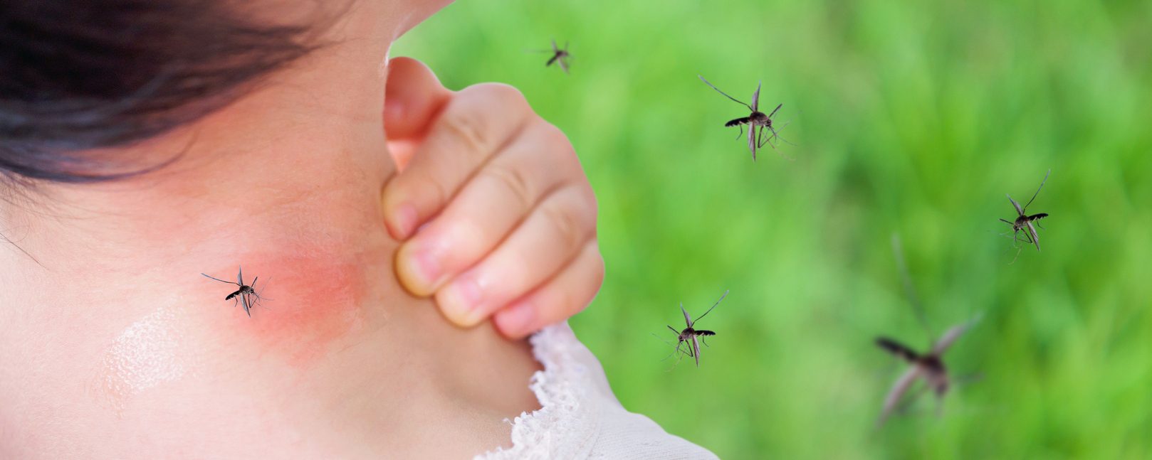 5 طرق طبيعية لمنع البعوض من الاقتراب منك