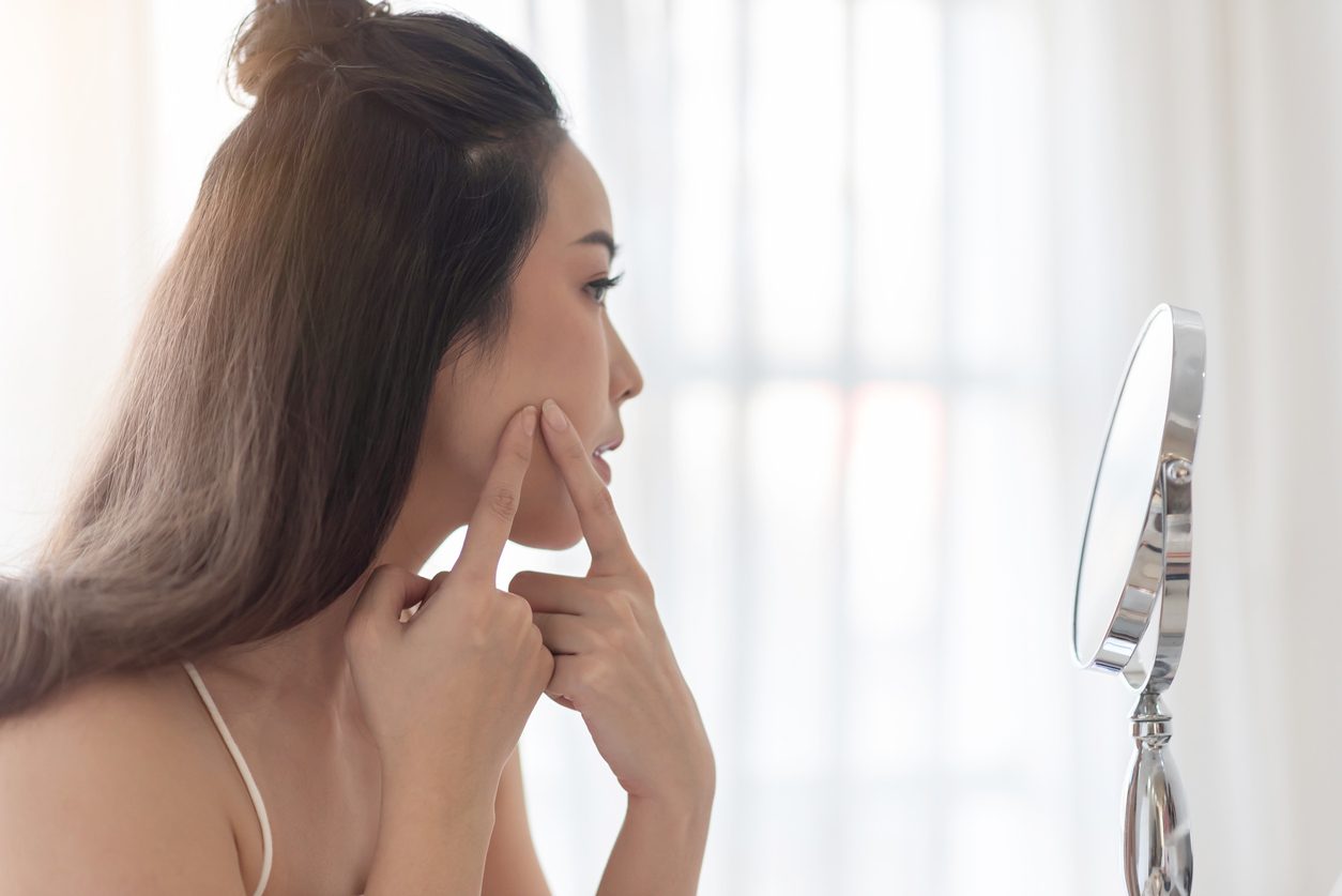 iStock/ بثور الوجه