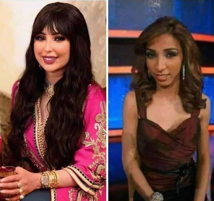 دنيا بطمة تجميل