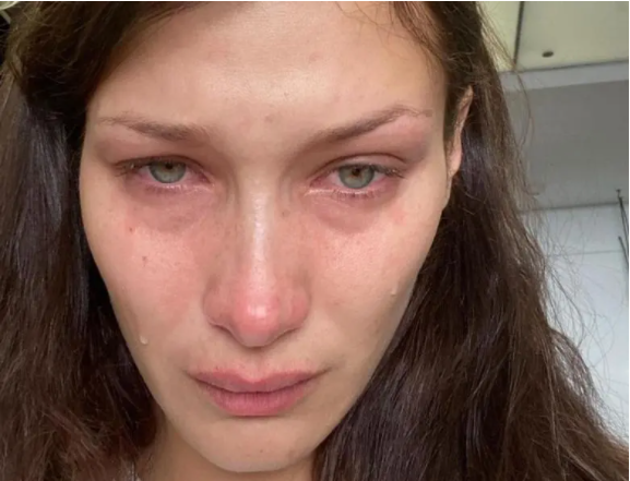 بيلا حديد تفاجئ جمهورها بظهورها الحزين.. نشرت صوراً وهي تبكي وقالت إن “السوشيال ميديا” لا تعكس الحقيقة