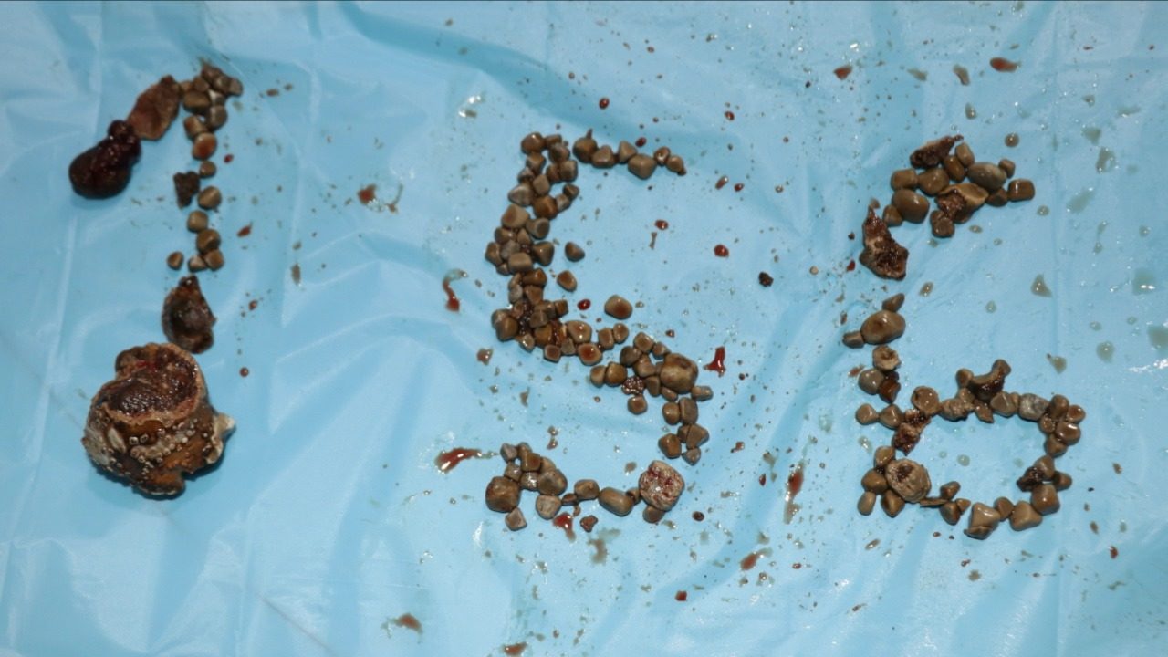 الهند
