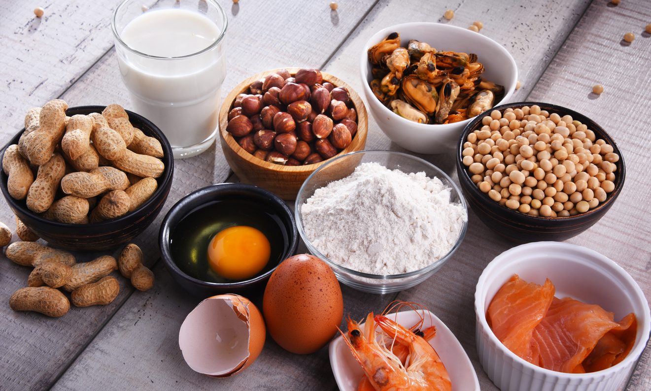 أنواع وأسباب حساسية الطعام