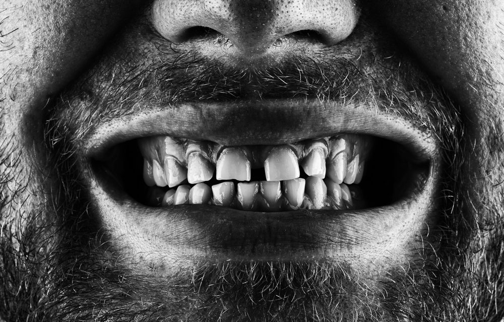 Shuter Stock/ طب الأسنان الشرعي