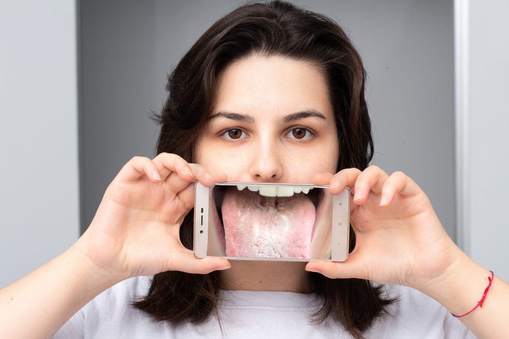 تصيب الأطفال وكبار السن وتسبب العدوى لثدي الأم المرضع.. ماذا تعرف عن فطريات الفم؟