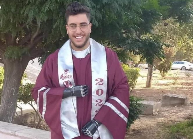 هل تذكرون “فتى الزرقاء” الذي قطعت يداه وفقئت عينه؟ حقق نجاحاً بالثانوية العامة رغم ما مر به (فيديو)