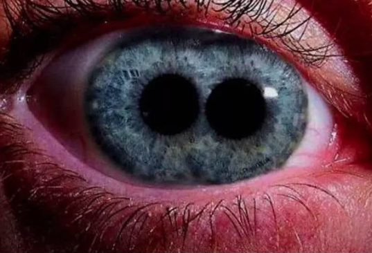 Polycoria