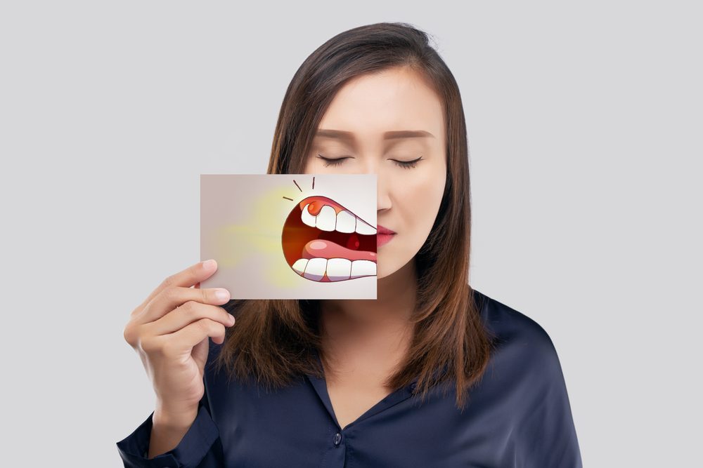 حبة صغيرة قد تمنعك من النوم طوال الليل.. كيف تتخلص من ألم “خراج الأسنان”؟