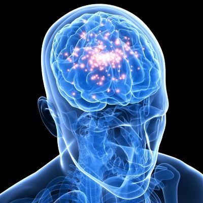 متلازمة السيروتونين