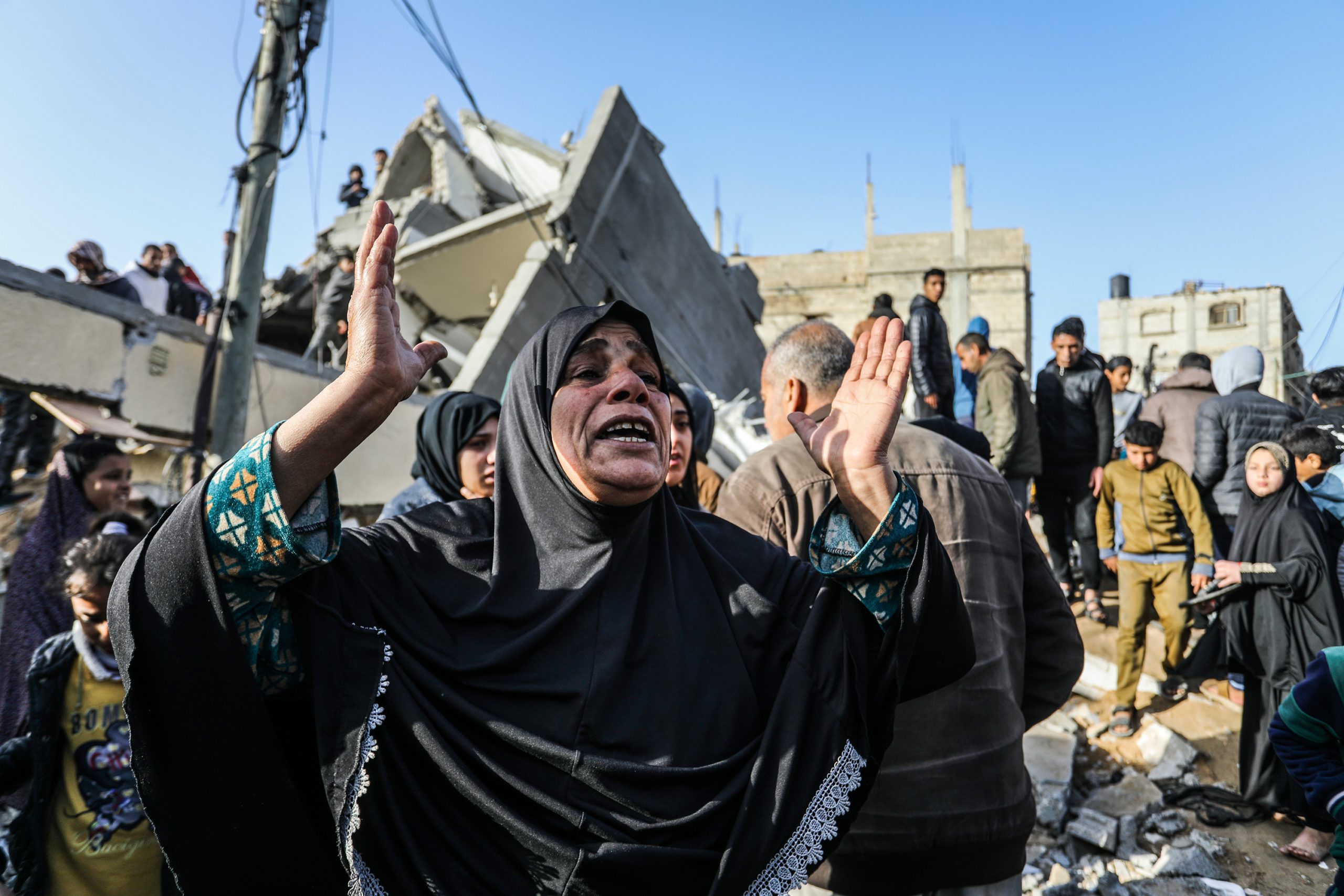 تحول إلى هيكل عظمي.. صور مؤثرة للطفل الفلسطيني يزن الكفارنة بعد وفاته بسبب الجوع والحصار في غزة 