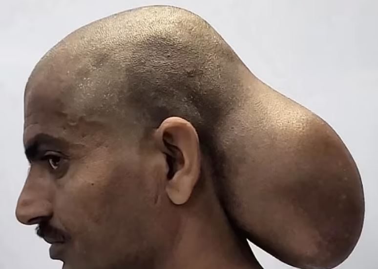 رجل برأسين