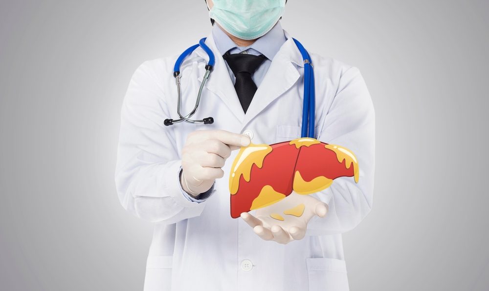 الكبد الدهني